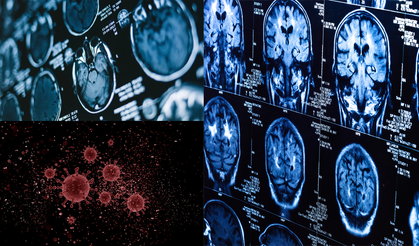 Araştırma: 'COVID-19 beyni yaşlandırdı'